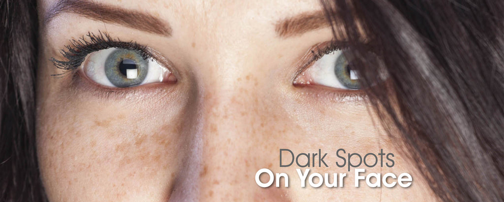 Dark Spots on Face